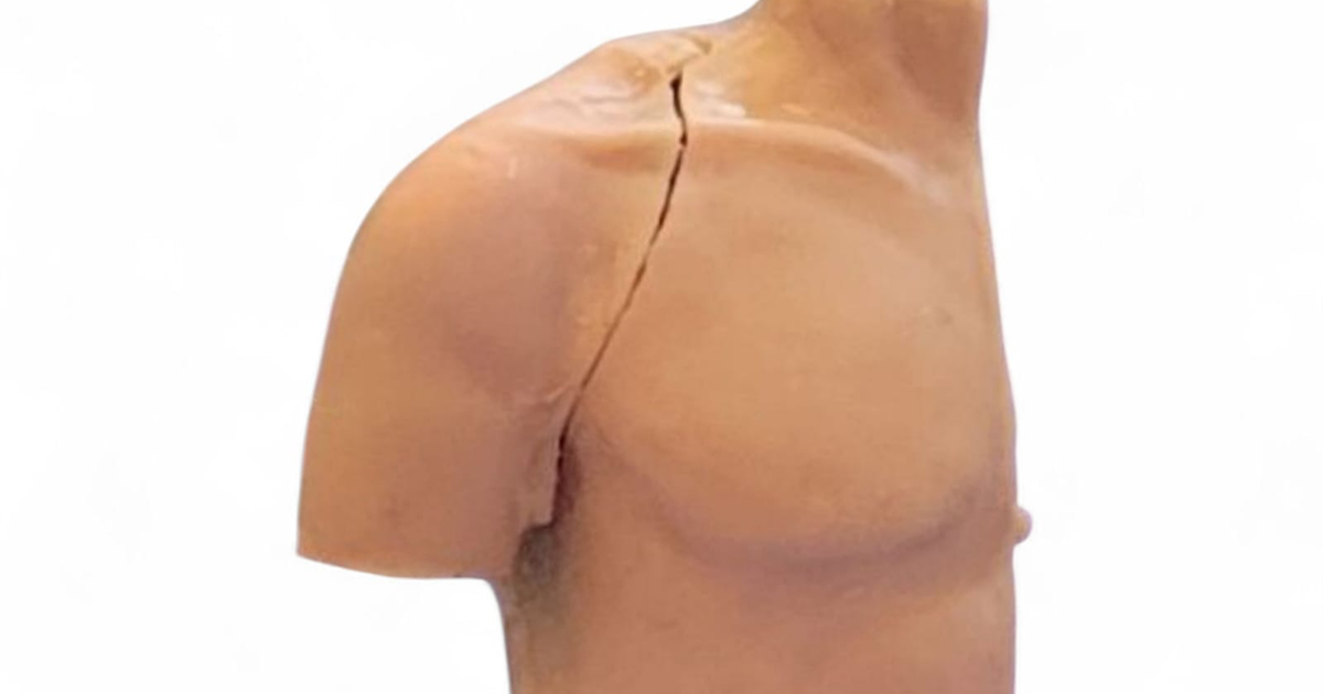 MSK Intervention Clinical Training Series | One Simulation