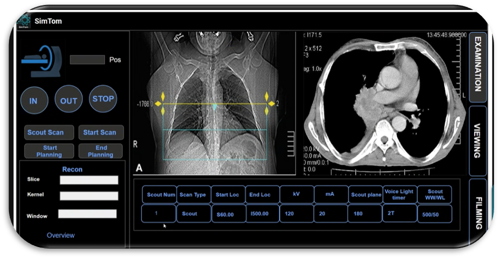Ct Scan Simulation SIMTOM Radiation-Free CT Simulator | One Simulation